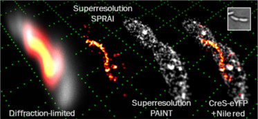 Imaging the bacterial cell surface and an internal protein in 3D